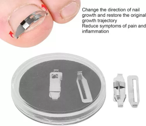 merkloos Ingegroeide teennagelcorrector (2 stuks) Roestvrijstalen paronychia-correctietool (8785306004007)