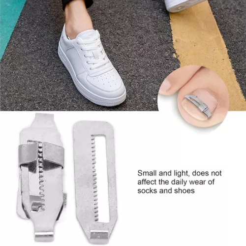 merkloos Ingegroeide teennagelcorrector (2 stuks) Roestvrijstalen paronychia-correctietool (8785306004007)