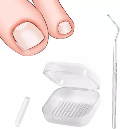 40 stuks strips voor het gladmaken van ingegroeide teennagels, inclusief nagellifter, voor de correctie van ingegroeide teennagels.