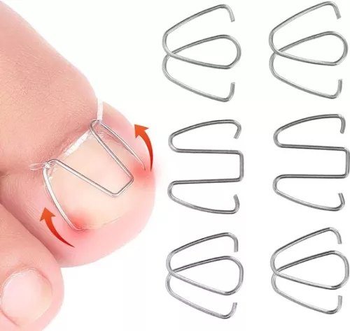 Ingegroeide teennagelcorrectiehaakje - Nagelcorrectiestrips, draadlifter voor herstel - Corrector voor dames en heren.